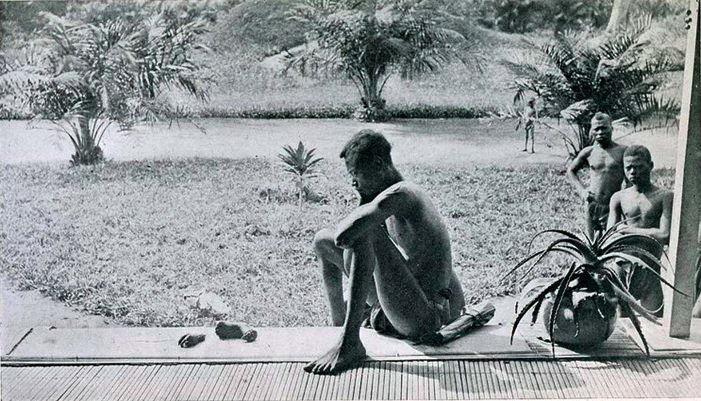 G:\pix\1904 Father stares at the hand and foot of his five-year-old, severed as a punishment for failing to make the daily rubber quota, Belgian Congo, 1904.jpg